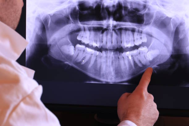 Best Emergency Dental Services for Seniors in Morgan Hill, CA