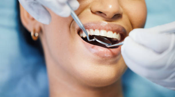 Best Emergency Dentist for Special Needs Patients in Morgan Hill, CA