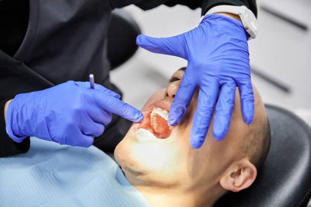 Best Emergency Dentist for Knocked-Out Tooth in Morgan Hill, CA